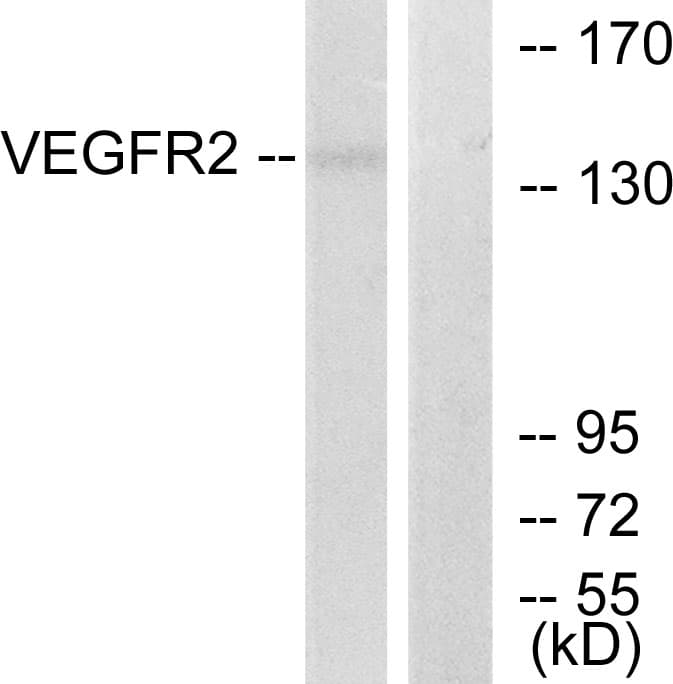 Polyclonal Rabbit anti-Human KDR / VEGFR2 / FLK1 Antibody (aa1180-1229, IHC, WB)