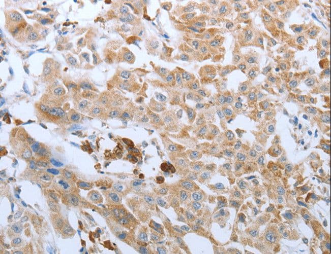 FGF1 / Acidic FGF Antibody