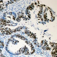 Polyclonal Rabbit anti-Human LMNA / Lamin A+C Antibody (phospho-Ser392, IHC, IF, WB)