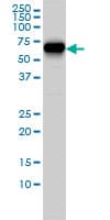 IHC-plus™ CORO1B Antibody (clone 1E7)