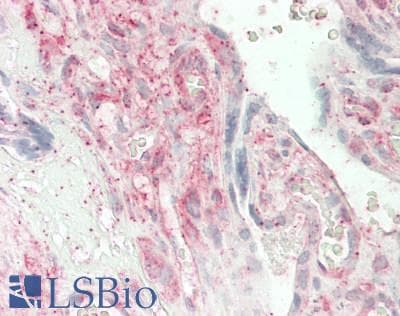 IHC-plus™ ANGPTL4 Antibody (Coiled-coil domain, clone Kairos4-397G)