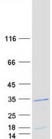 Human AK6 / Adenylate Kinase 6 Protein (Recombinant Myc-DDK (Flag))