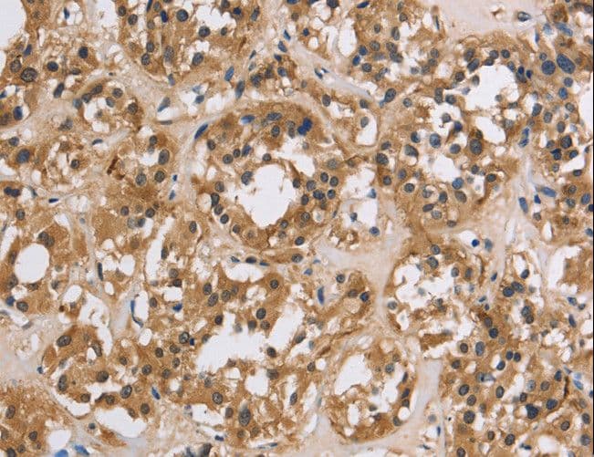IMPDH1 Antibody