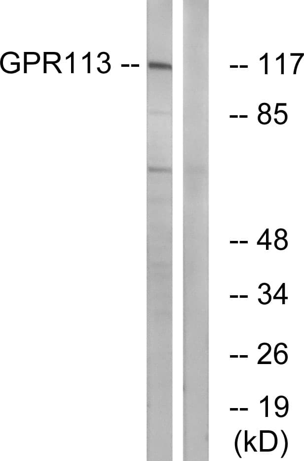 ADGRF3 / GPR113 Antibody (aa21-70)