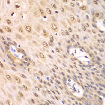 Polyclonal Rabbit anti-Human PSMA2 Antibody (IHC, IF, WB)