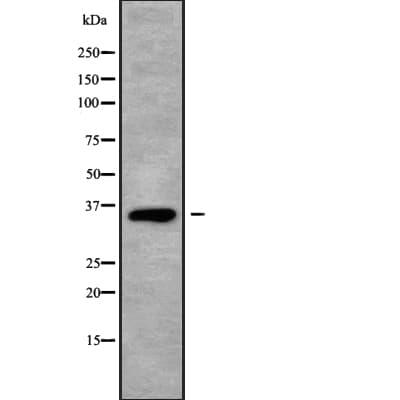 MAGEA3 Antibody