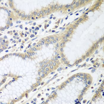 Polyclonal Rabbit anti-Human RPN2 / Ribophorin II Antibody (IHC, WB)