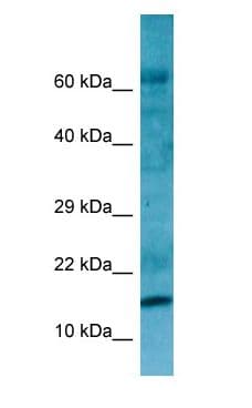 RPL27A Antibody (C-Terminus)