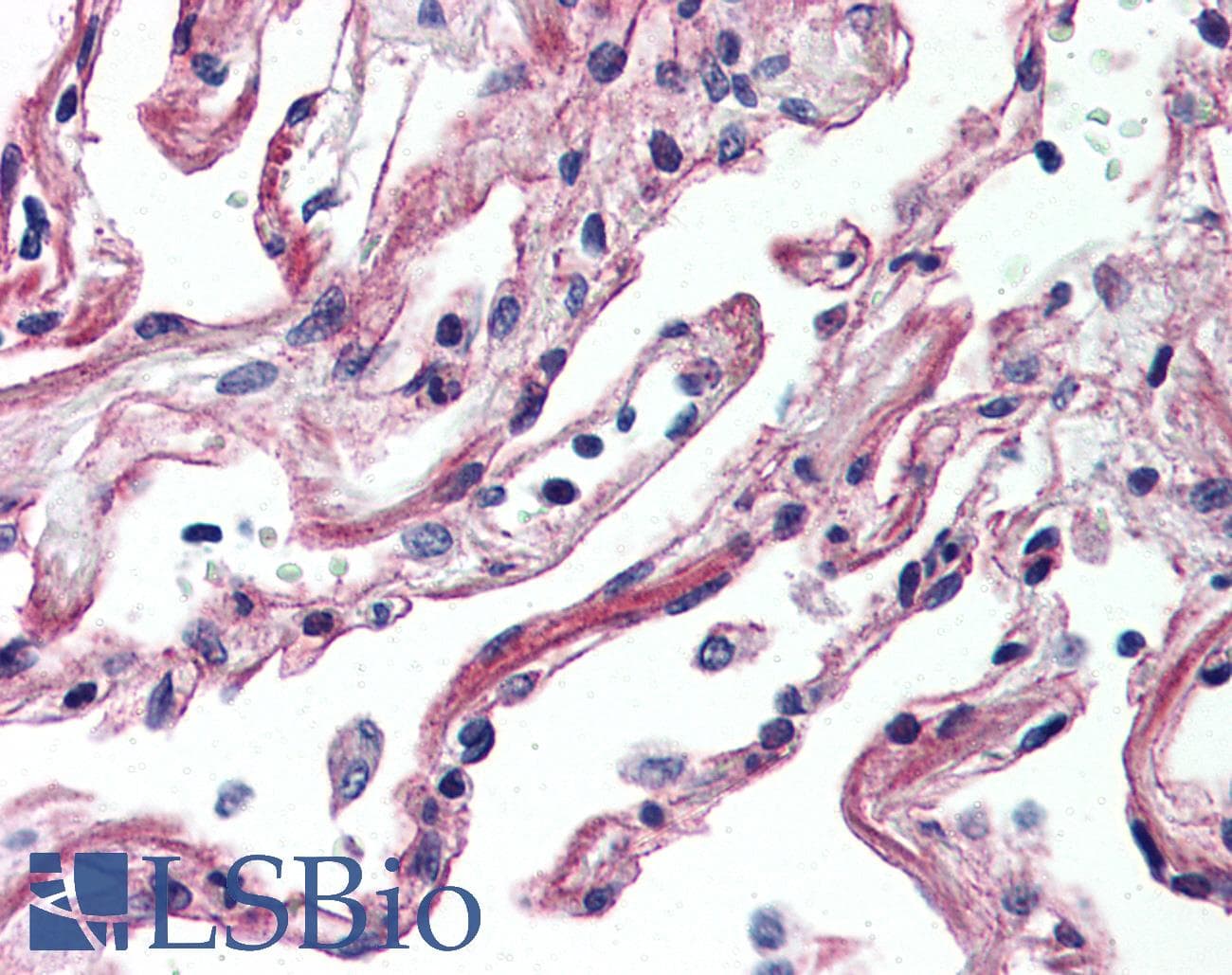 PathPlus™ ADORA2A/Adenosine A2A Receptor Antibody (C-Terminus)