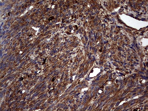 Monoclonal Mouse anti-Human GBA / Glucosidase Beta Acid Antibody (clone OTI4G4, aa40-315, IHC, WB)