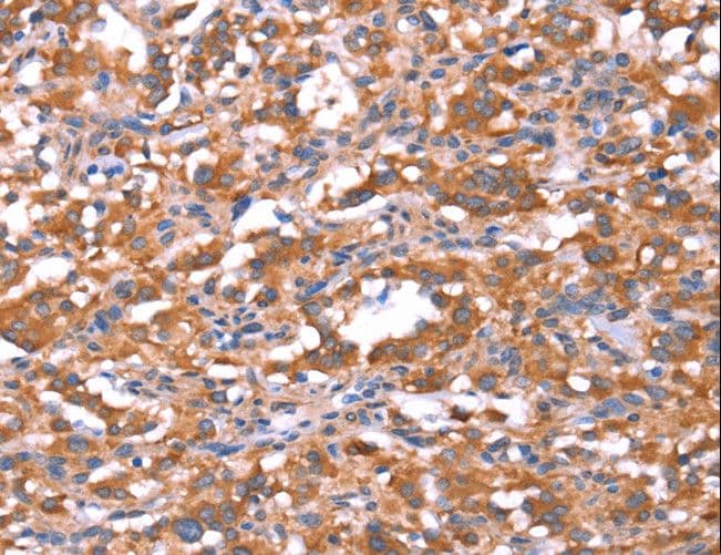 FAM13B Antibody