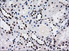 RPA2 / RFA2 / RPA34 Antibody (clone OTI8B3)