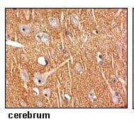 Polyclonal Rabbit anti-Human SLC4A10 Antibody (IHC)