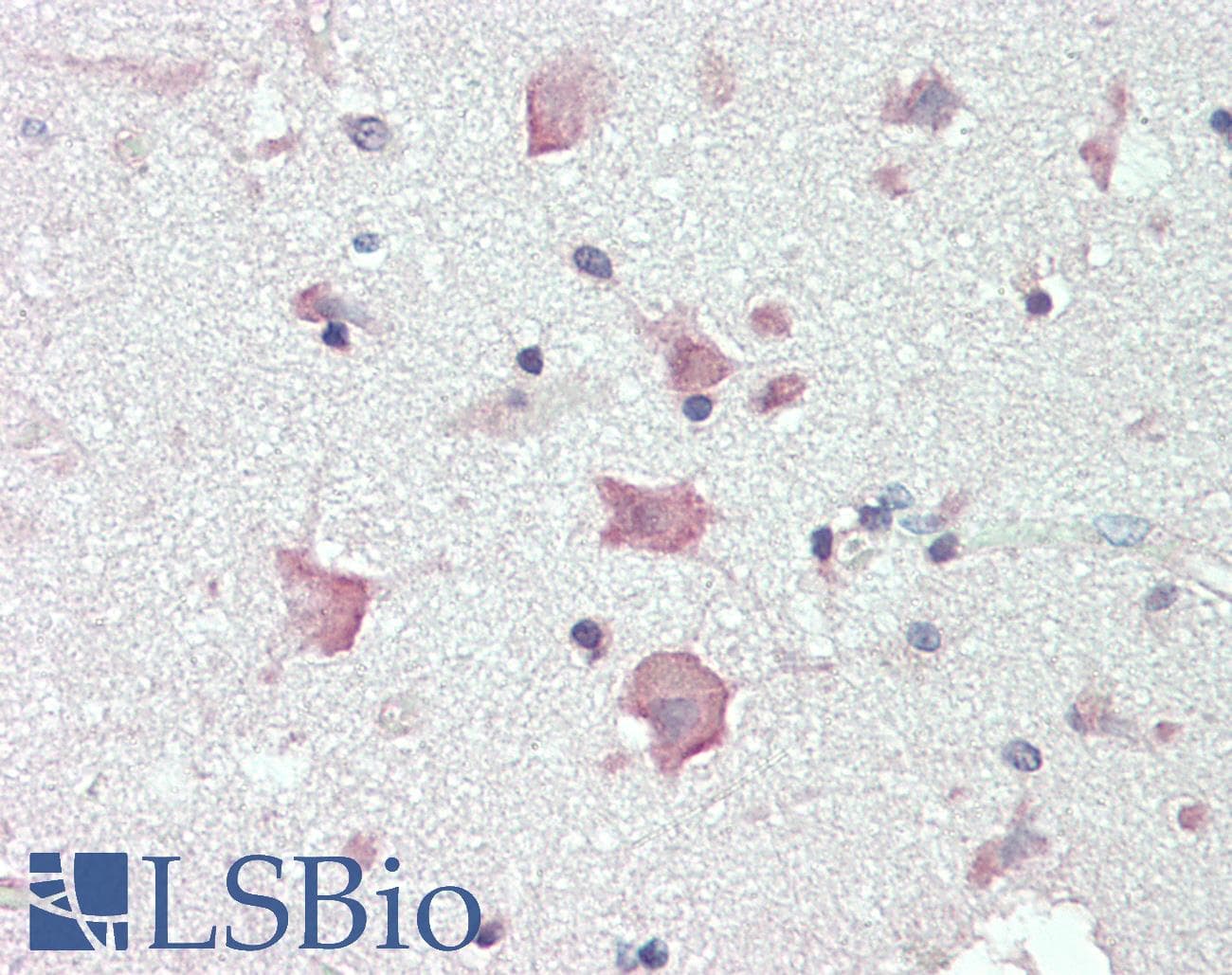 IHC-plus™ Acetyl-CoA Carboxylase / ACC Antibody (aa1925-1975)