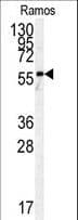 Polyclonal Rabbit anti-Human PKM / Pyruvate Kinase, Muscle Antibody (aa476-505, IHC, IF, WB)