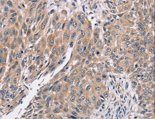 PPP1CC / PP1 Gamma Antibody