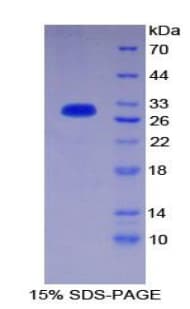 Human PIK3C2A Protein (Recombinant His-T7)