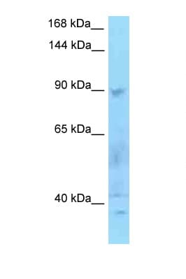 SECISBP2 / SBP2 Antibody (aa159-208)