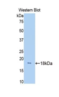 HPX / Hemopexin Antibody (aa235-378, Biotin)