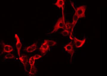 Carboxypeptidase Z / CPZ Antibody