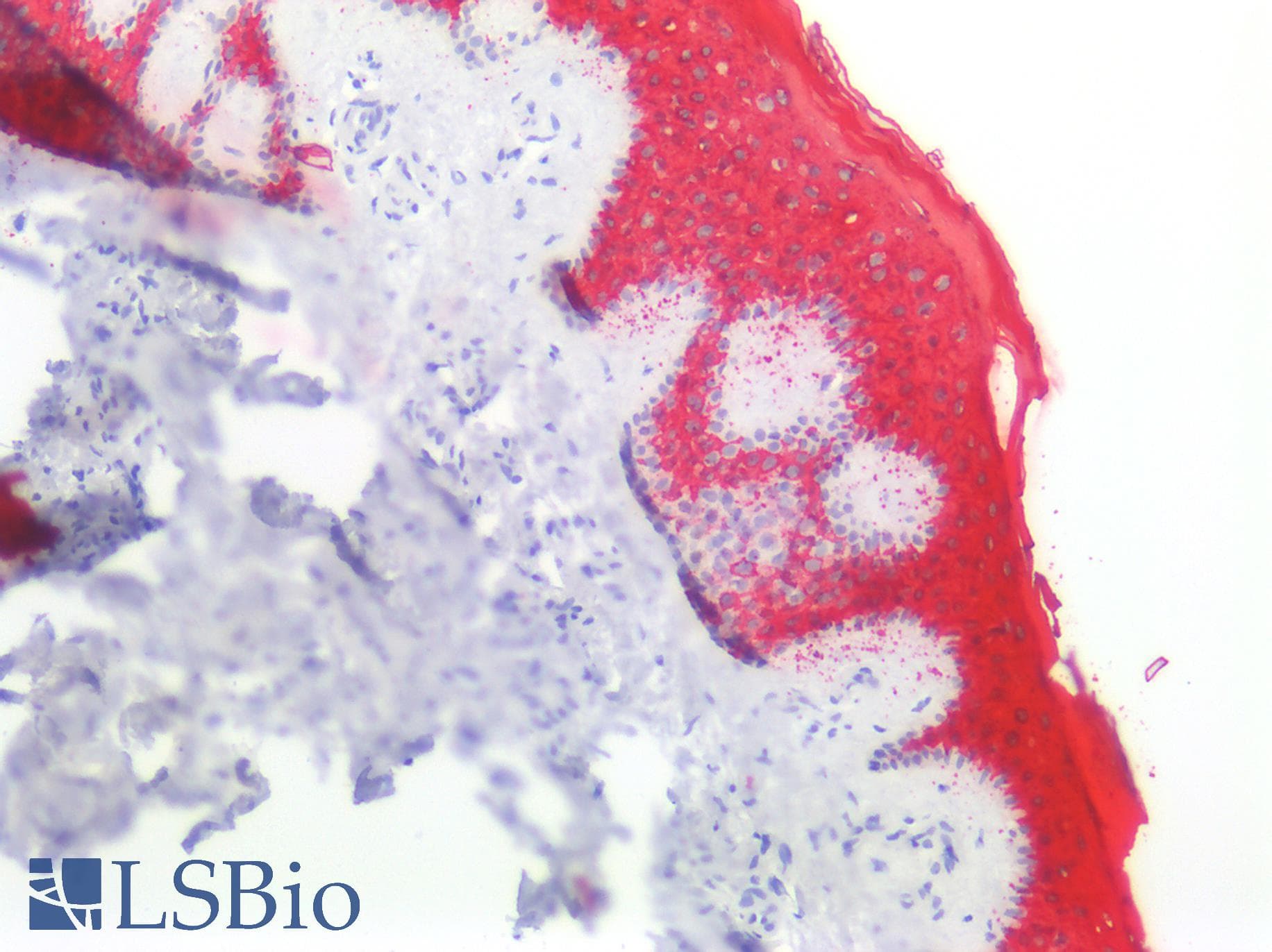 PathPlus™ KRT10 / CK10 / Cytokeratin 10 Antibody