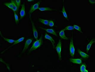 Polyclonal Rabbit anti-Human YTHDF2 Antibody
