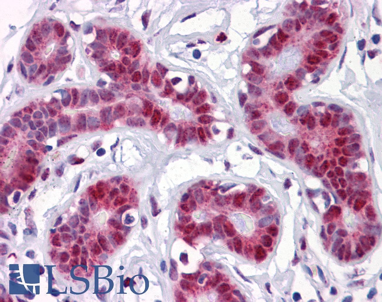 IHC-plus™ Monoclonal Mouse anti-Human TSC22D3 / GILZ Antibody (clone 3A5, IHC, IF, WB)