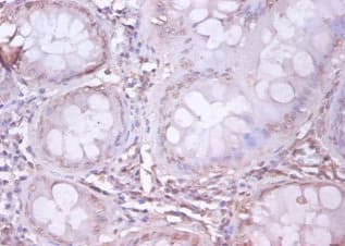 Polyclonal Rabbit anti-Human APP / Beta Amyloid Precursor Antibody (IHC, WB)