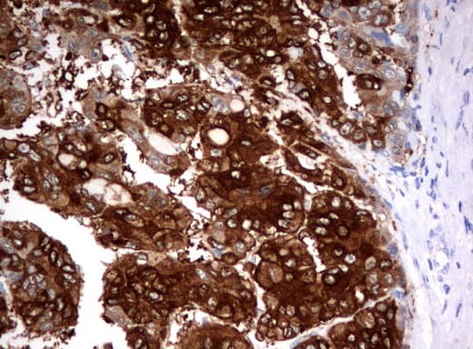 FTCD / 58K Golgi Protein Antibody (clone UMAB123)
