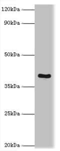 TRAIL-R4 / DCR2 Antibody (aa257-386)