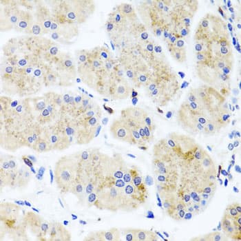 MNK / ATP7A Antibody