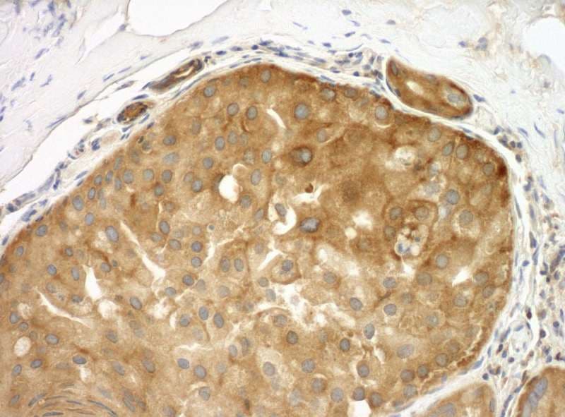 SEPT9 / Septin 9 Antibody (aa536-586)