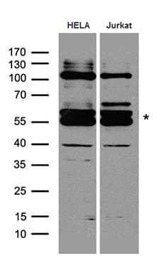 FANCE Antibody