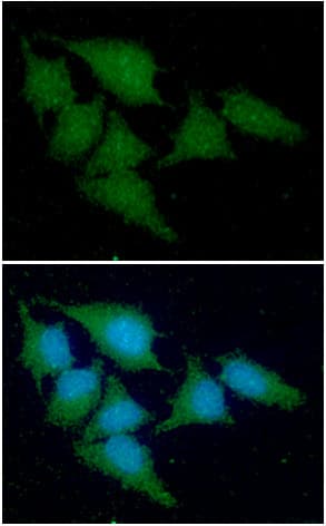 CSTA / Cystatin A Antibody (clone AT1B12)