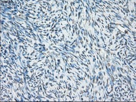 CYPOR / POR Antibody (clone OTI5B3)