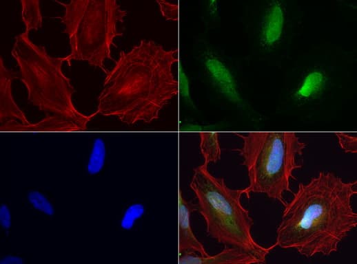 Monoclonal Mouse anti-Human WIBG Antibody (clone UMAB209, IHC, IF, WB)