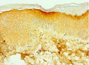 Polyclonal Rabbit anti-Human TNXB / Tenascin XB Antibody (aa3933-4242, IHC)
