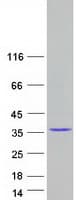 Human RNF135 Protein (Recombinant Myc-DDK (Flag))