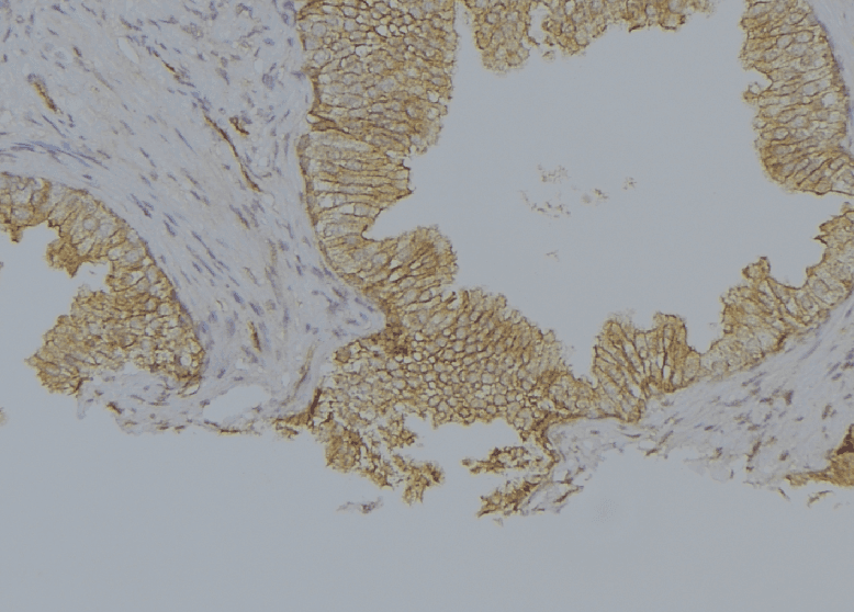 KRT10 / CK10 / Cytokeratin 10 Antibody