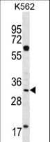 Polyclonal Rabbit anti-Human FCN3 / Ficolin-3 Antibody (aa214-243, IHC, WB)