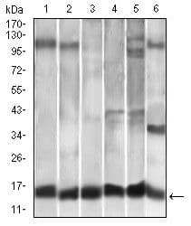 Monoclonal Mouse anti-Human CCL2 / MCP1 Antibody (clone 2D8, IHC, IF, WB)