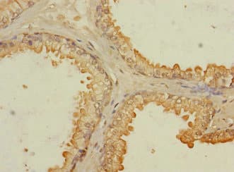 Polyclonal Rabbit anti-Human RASSF6 Antibody (IHC)