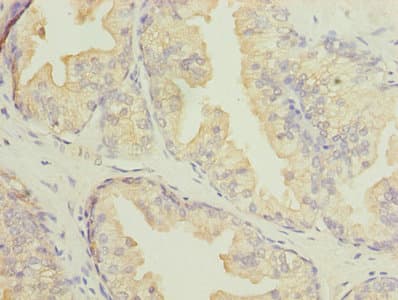 Polyclonal Rabbit anti-Human DNALI1 Antibody (IHC, WB)