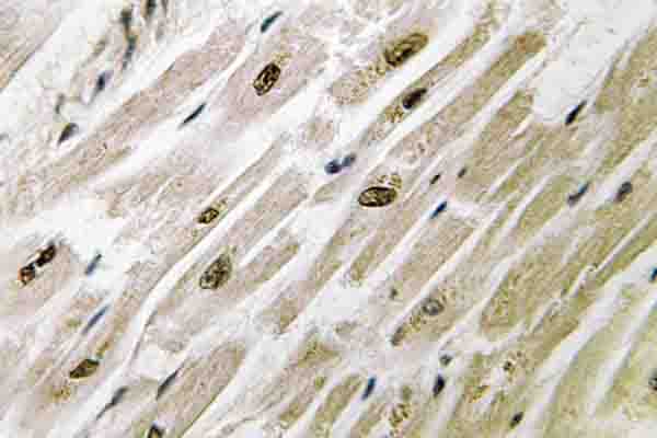 Polyclonal Rabbit anti-Human PAK2 Antibody (Arg186, IHC, WB)