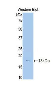 HIF1A / HIF1 Alpha Antibody (aa216-337, Biotin)