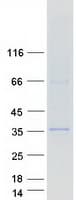 Human ARMC10 Protein (Recombinant Myc-DDK (Flag))