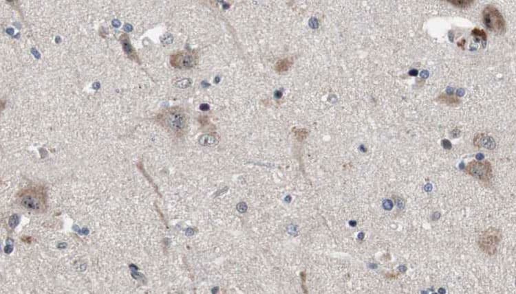 EXOC2 / SEC5 Antibody
