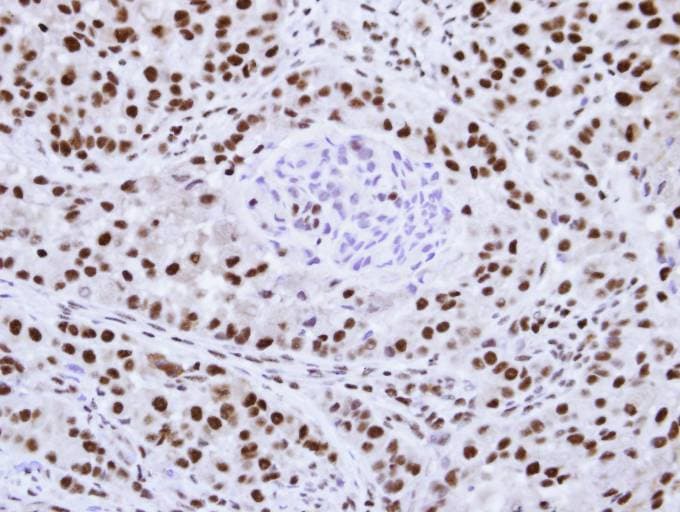 HNRNPF / hnRNP F Antibody (aa1-204)