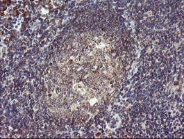 GCP60 / ACBD3 Antibody (clone OTI5F9)
