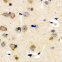 KLKB1 / Plasma Kallikrein Antibody (Internal)